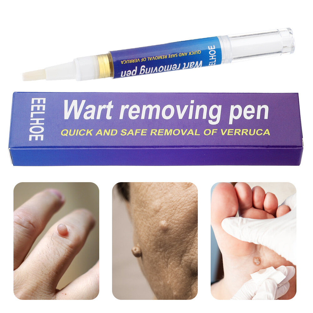 2-Pack Wart Remover Pen for Skin Tag and Mole Removal - Pain-Free, Fast-Acting