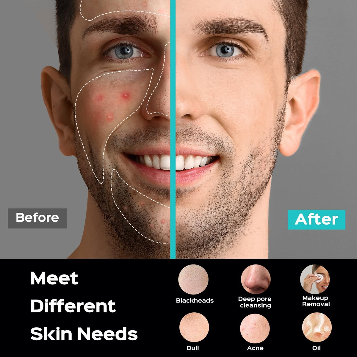 Facial Cleansing Brush for Deep Skin Pore Cleaning and Exfoliation