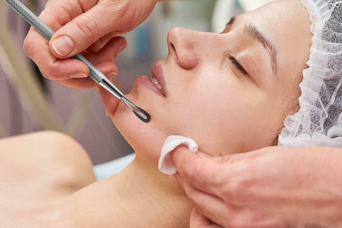 Stainless Steel Blackhead Remover Tool for Acne Pimple Extraction - Double-Ended Comedone Extractor
