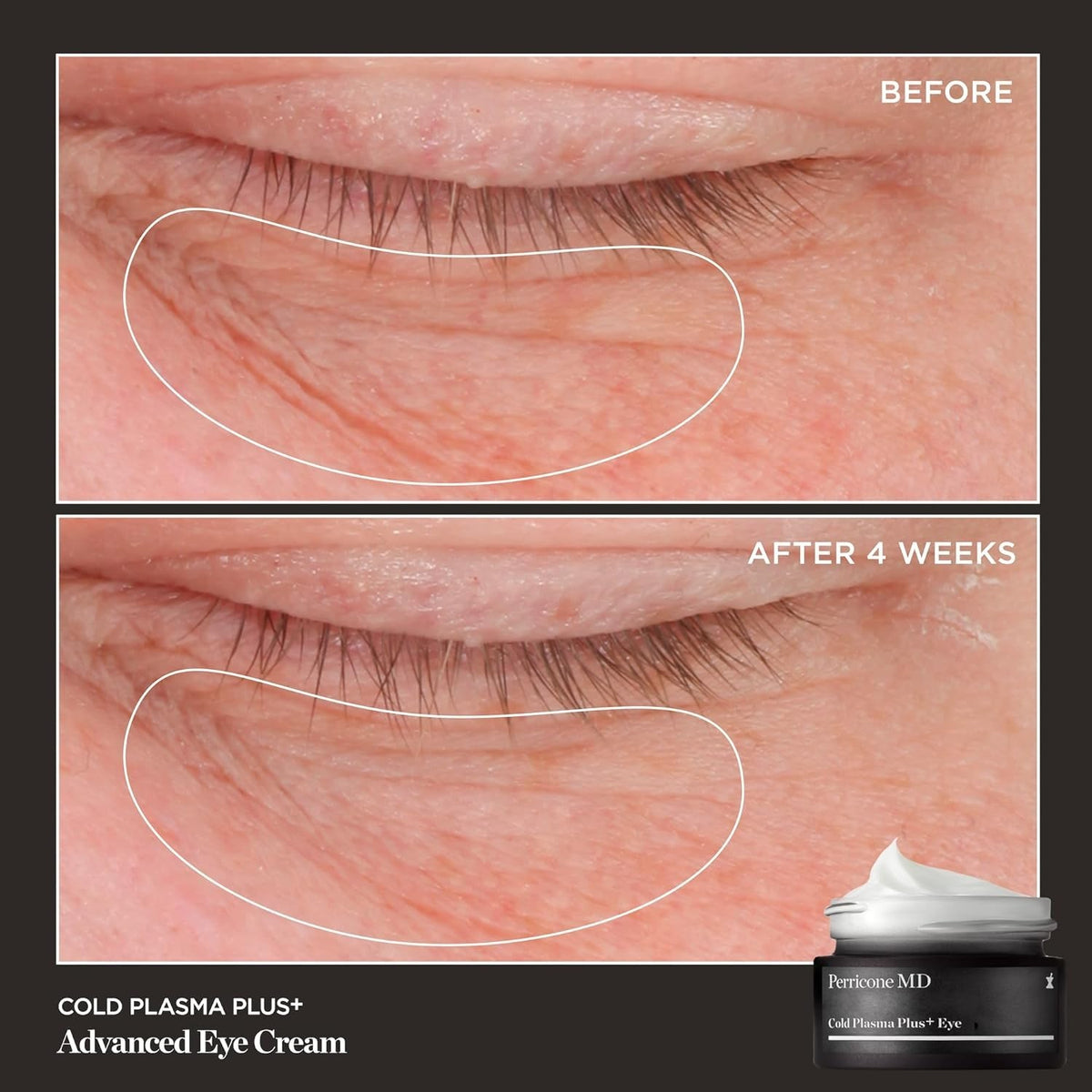 Youthful Eye Cream for Dark Circles Puffiness Fine Lines Firmness 0.5 fl oz