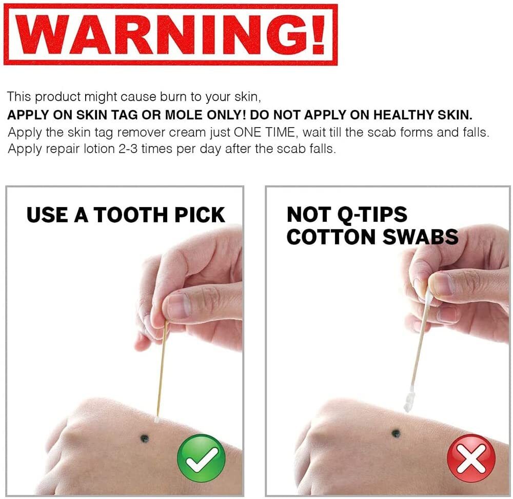 Skin Tag Remover Liquid for Mole & Wart Removal - Safe & Fast Treatment