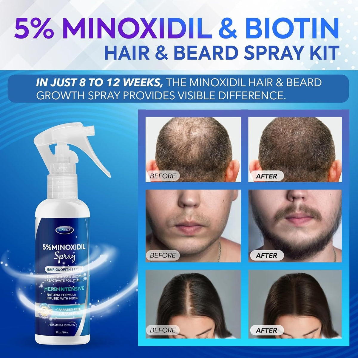 Dabida 5% Minoxidil Hair Growth Treatment & Beard Spray, 60ml