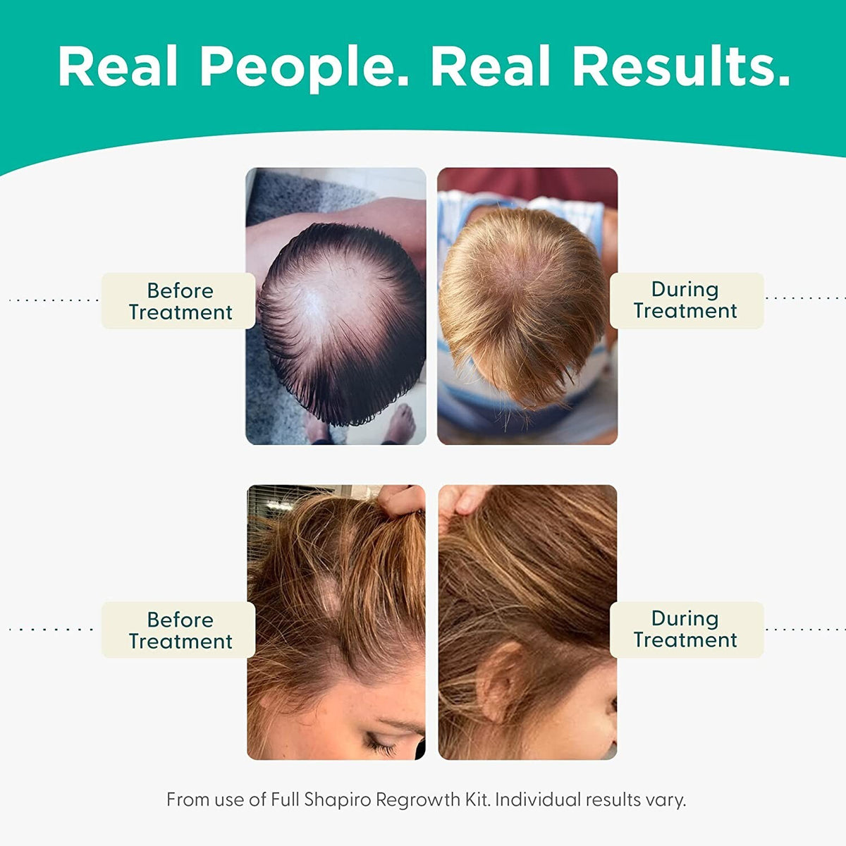 DHT Blocking Hair Loss Shampoo & Conditioner Bundle