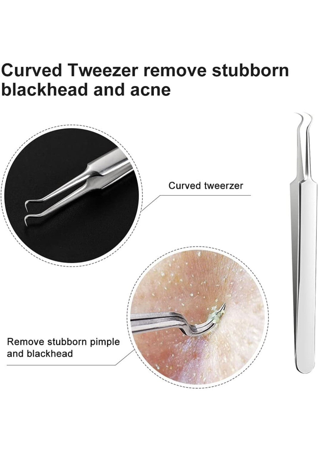 3-Piece Blackhead Remover Kit - Pimple & Acne Extraction Tools Set