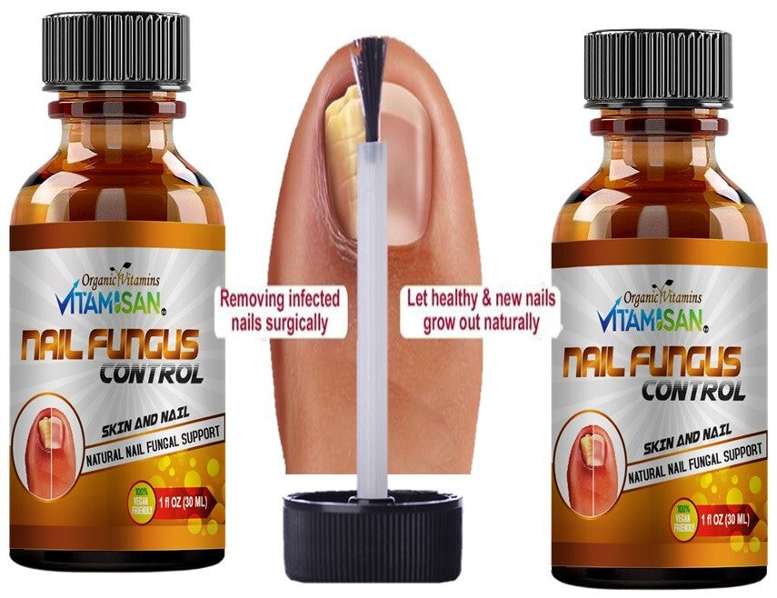 Anti-Fungal Nail Fungus Treatment Kit with Brush & Liquid - Supports Healthy Nails