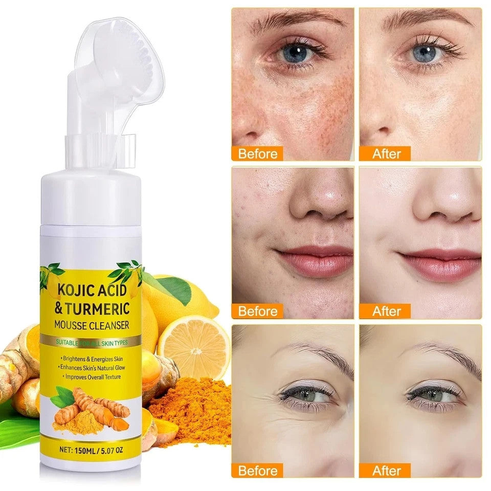 Turmeric & Kojic Acid Facial Cleanser with Brush for All Skin Types