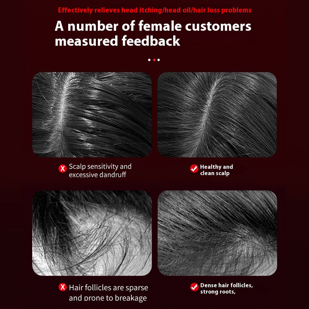 Electric Scalp Massage Brush with Red Light Therapy for Hair Growth - Deep Nourishing Hair Care Comb