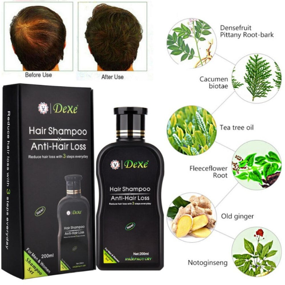 Anti Hair Loss Shampoo for Women & Men – Herbal Hair Growth Treatment