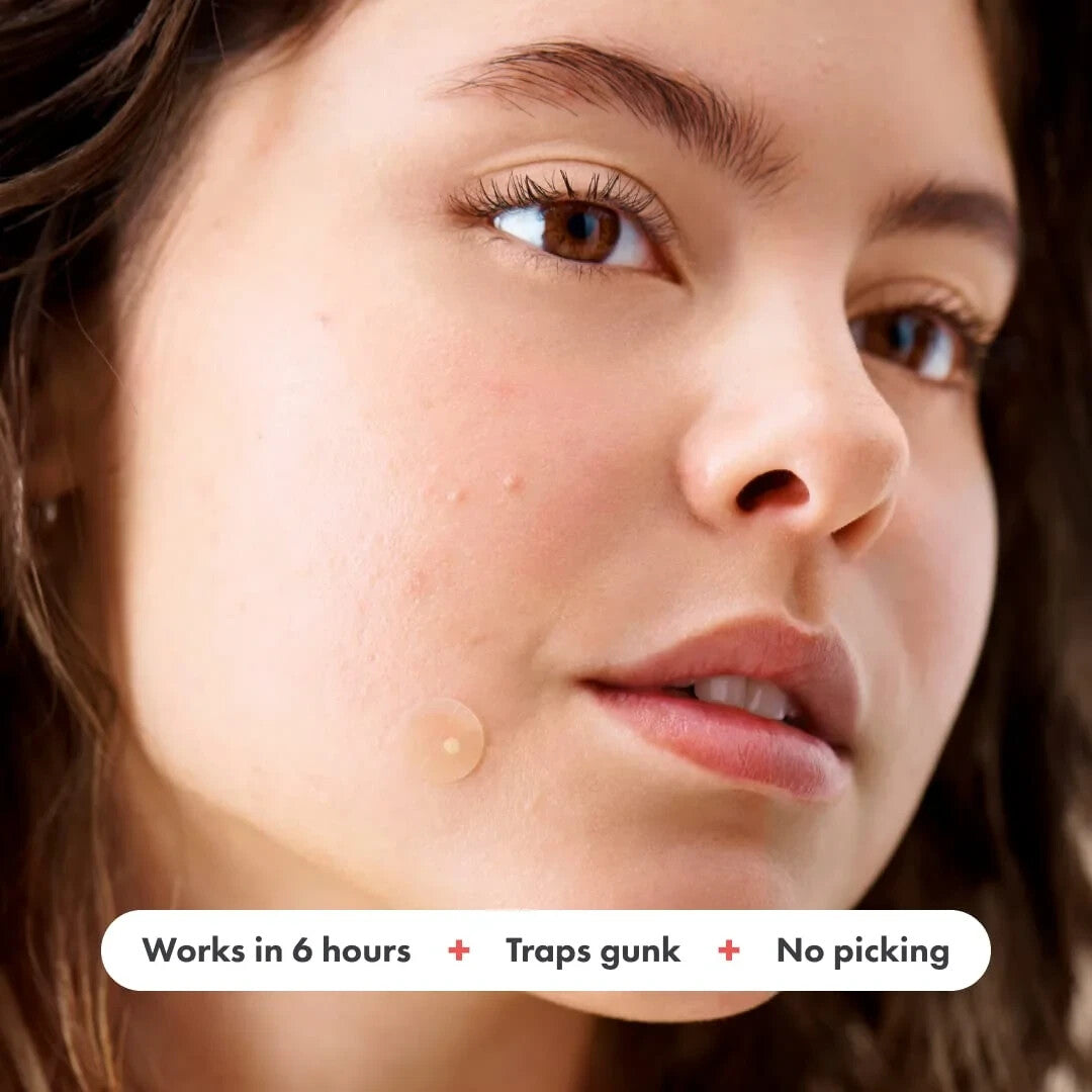 Acne Pimple Spot Patch Hydrocolloid with Essential Oils - Blemish Skin Care