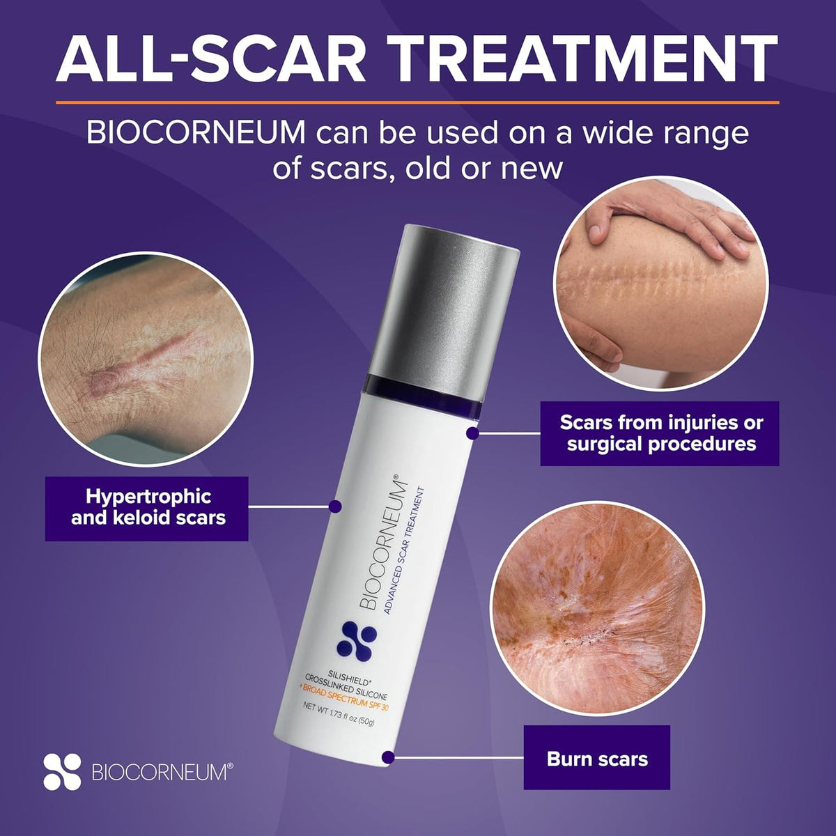 Scar Treatment Gel with SPF 30 – Silicone Formula for Old & New Scars, 10G