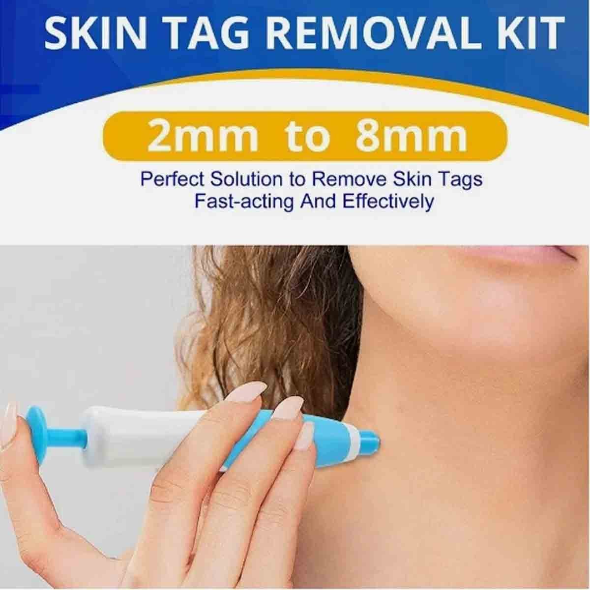 Painless Skin Tag Remover Pen Kit - 2-in-1 Wart & Mole Removal Tool