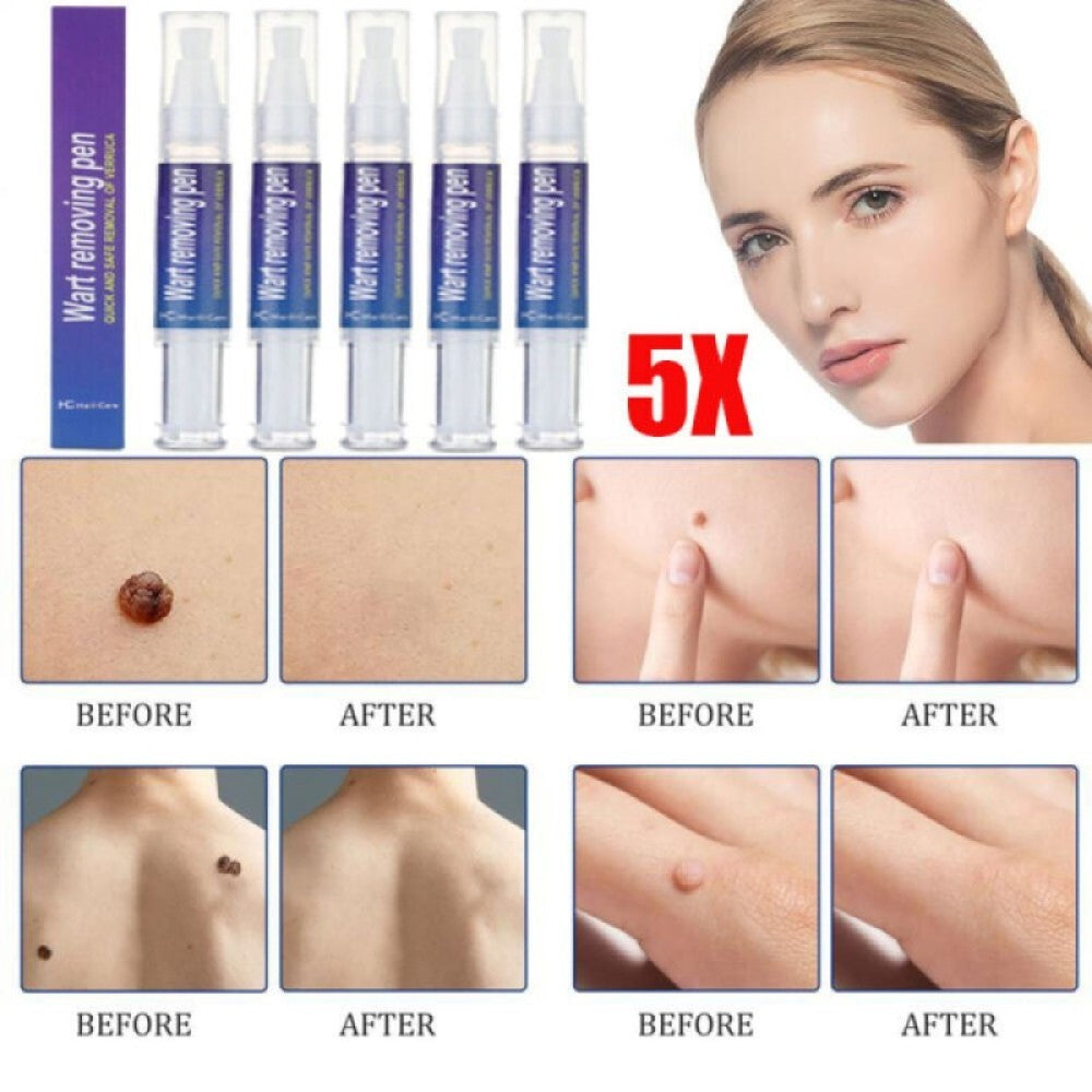 Herbal Wart Removal Pen for Hand, Foot, Flat & Filiform Warts - Set