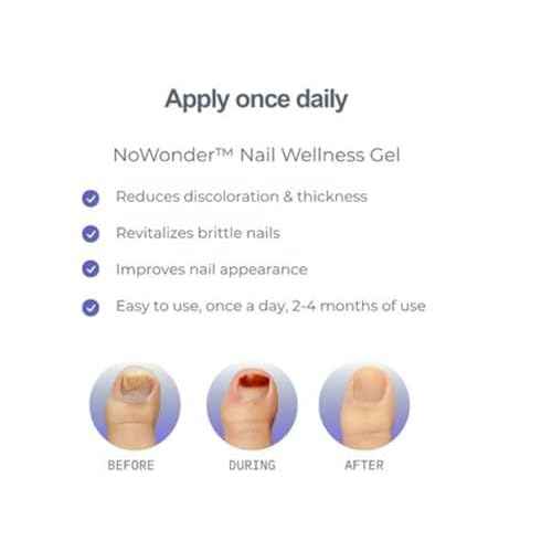 NoWonder Nail Wellness Gel | Nitric Oxide Creating Nail Renewal Solution | Supports Clearer, Healthier Nails | Non-Prescription, Safe & Easy-to-use, Nail Care, with Visible Results