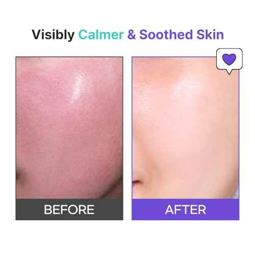 TIA'M Snail & Azulene Calmfort Cream, 3.38 fl oz, 92% Snail Mucin, Lightweight Calming & Moisturizing Cream for Soft, Glass Skin, Korean Skin Care, Day & Night Moisturizer Face Cream