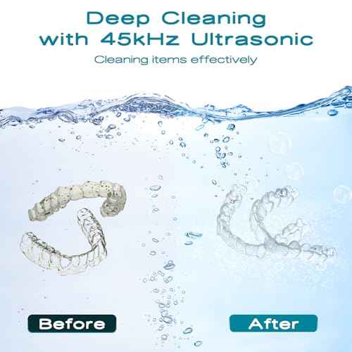 Ultrasonic Retainer Cleaner, White? Ultrasonic Retainer Cleaning Machine, Cleaner for Denture,Nightguard,Mouth Guard, Touch Retainer Cleaner.