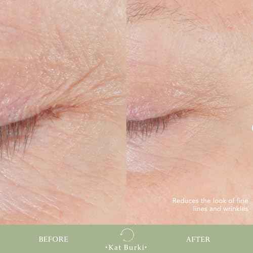 Kat Burki Form Control Marine Collagen Face Serum. Clinically Proven Anti-Aging Care Promoting Collagen Production: Lifts, Plumps & Contours Skin