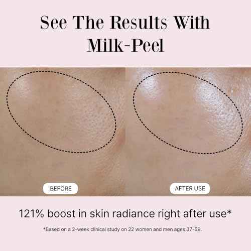 Milkpeel Toner to Essence ? Gentle Daily Exfoliating, Hydrating Toner for Smooth, Radiant Skin, Strengthens Moisture Barrier, Perfect for Sensitive Skin, Balanced, Healthy Glow, 200ml