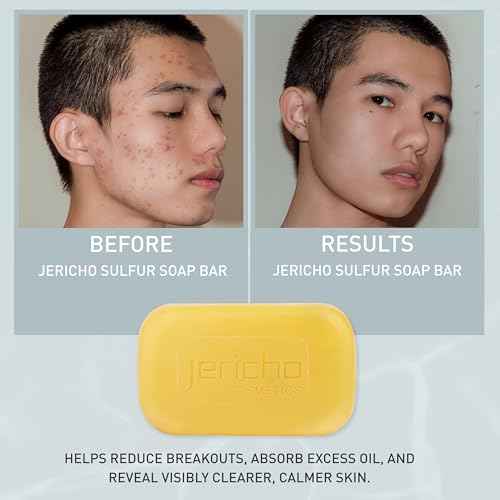 Jericho Dead Sea Sulfur Soap with Olive Oil ? Helps with Acne, Psoriasis, Eczema & Blackheads ? For Oily to Normal Skin ? Vegan Face & Body Bar for Men & Women, 4.4 Oz / 125 g (Pack of 6)