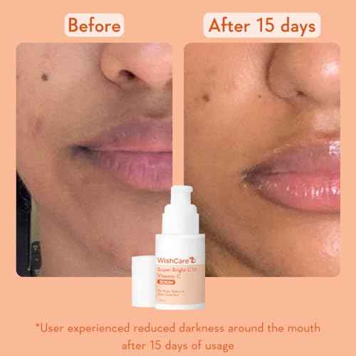 WishCare Vitamin C Face Serum with Niacinamide, Ferulic Acid & Botanical Extracts ? Serum for All Skin Types, 30ml