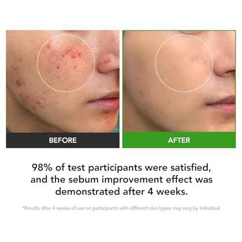 31% Reduction in Sebum & 15.5% High-Dose D-Panthenol ? Calms Redness, Repairs Skin Barrier & Locks in Hydration ? With Heartleaf Extract & Hyaluronic Acid ? Korean Skincare Top Barrier Cream