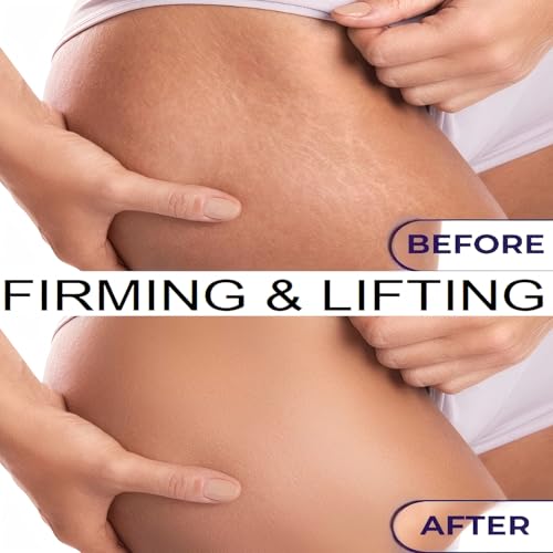 Luxury Body Firming Oil Tightening & Hydrating Treatment After Shower Body Oil For Women | Natural Body Luxury Oil for Dry Skin | Lightweight, Non-Greasy, Nourishing Formula ? 4.06 FL OZ
