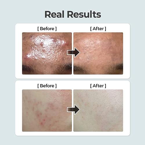 numbuzin No.1 Toner | Pure-Full Calming Herb Toner | Breakouts, Redness, Excess Oil Control | Centella Asiatica, Heartleaf, Licorice Root | Acne-Prone, Sensitive Skin | 10.14 fl. oz.