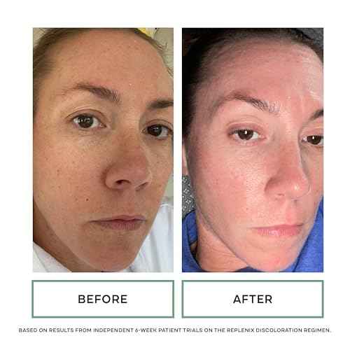 Replenix Age Restore Bio-Repair Serum, Anti-Aging Brightening Face Treatment with Medical-Grade Antioxidants (1.7 oz)