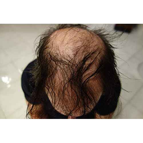 Hair Building Fibers 200 Grams 7 Oz. With Bottle By Finally Hair 50g*4 (Black)