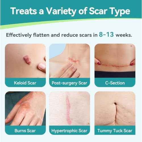Dimora Medical Grade Silicone Scar Sheets -Ultra Soft Silicone Scar Tape (1.6¡±x60" Roll), Hypoallergenic Scar Removal Treatment for Surgical Scars, C Section, Tummy Tuck, Keloid Treatment