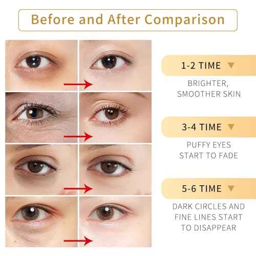 Tunbot Eye Mask - 60 Pieces - 24k Gold Eye Mask - Anti-Aging - Contains Collagen & Hyaluronic Acid - Removes Dark Circles, Puffiness & Wrinkles, Moisturizes - Home Skin Care