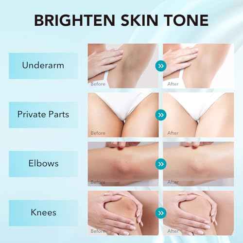 Skin Bleaching Cream, Skin Lightening for Intimate Areas, Moisturizing Cream Contain Vitamin C for Underarm, Armpit, Knees, Elbows, Inner Thighs and Bikini Area (1.7 Fl Oz)