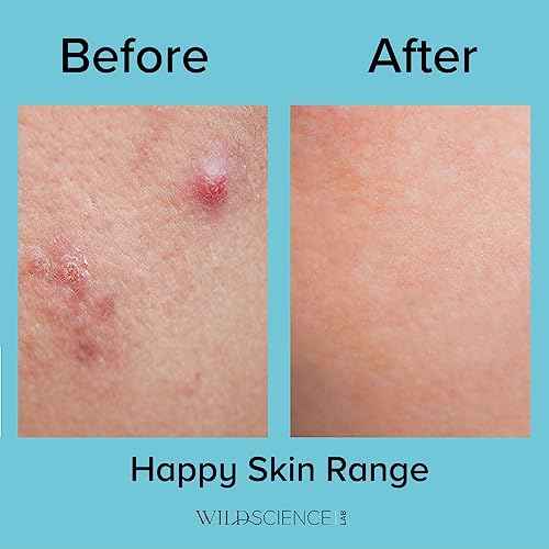 Wild Scicen Lab HAPPY BALANCE AHA + BHA + Zinc Clarifying Essence for Acne-Prone Skin