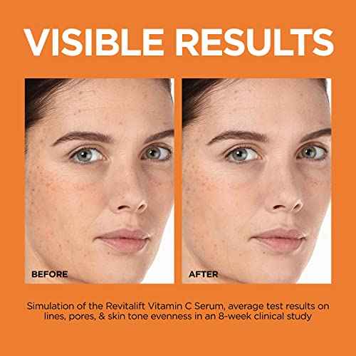 L'Oreal Paris Revitalift 12% Pure Vitamin C Serum, Brightening Serum For Face with Vitamin E, Salicylic Acid, 1 oz + Moisturizer Sample