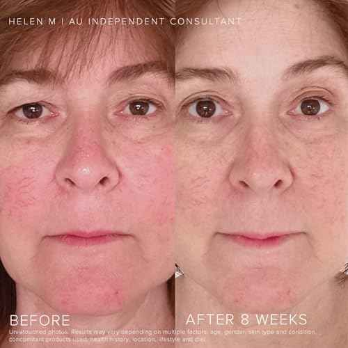 Rodan + Fields Soothe Daily Mineral Sunscreen SPF 30 | 1 Fl Oz | SPF Moisturizer for Face | Zinc Oxide Sunblock | Travel Size Sun Protection Skincare