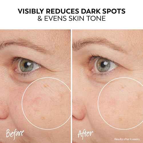 Olay Pro-X Dermatological Even Skin Tone Spot Fading Treatment Serum, 1.3 oz
