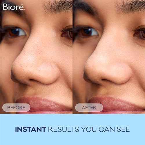 Bior? Original Blackhead Remover Strips, Deep Cleansing Nose Strips With Instant Pore Unclogging, Features C-Bond Technology, Oil-Free, Non-Comedogenic Use, 14 Count, Pack of 4