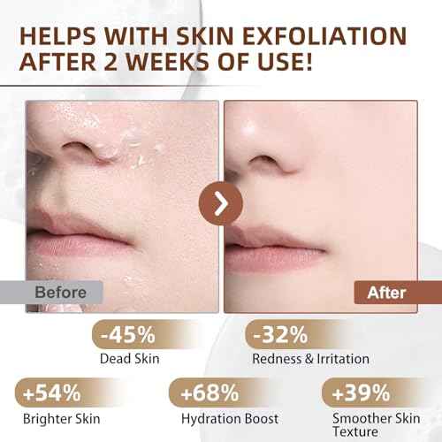 White Rice Peeling Glow Ampoule - Upgrade Skin Peel & Hydration Shot for Face and Body, Exfoliating Serum for All Skin Types, 80ml