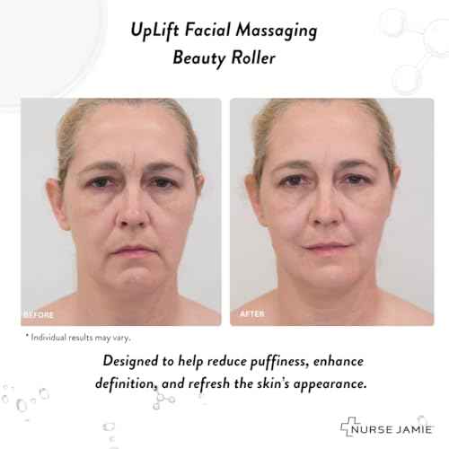 Nurse Jamie Clear Spot Treatment ? Fast-Acting Overnight Blemish Treatment with Salicylic Acid, Glycolic Acid & Sulfur