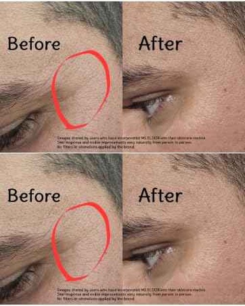 MS Elixir - Vitamin C Serum for Face - Niacinamide Hyaluronic Acid Facial Serum - Anti Aging Serum with Ceramides - Glow for Sensitive Skin - Dark Spot Corrector Hydrating - 30 ml