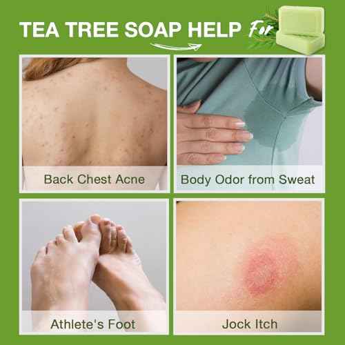 Tea Tree Antifungal Soap Bar ? Body Wash for Face & Body Acne, Folliculitis, Jock Itch, Ringworm, Athlete¡¯s Foot, Body Odor, Eczema ? 2¡¿4.1 oz
