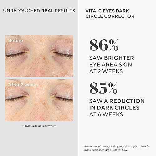 Murad Vita-C Eyes Dark Circle Corrector ? Gold-Stabilized Vitamin C, Algae, and Cucumber Eye Serum for Brightening, Reducing Puffiness, and Smoothing Fine Lines ? 0.5 Fl Oz