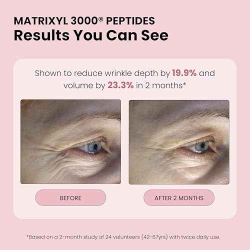 Rose Water Spray for Face with Matrixyl 3000 - Organic Rosewater Face Mist with Aloe Vera & Hyaluronic Acid - Hydrating, Reduces Fine Lines, Boosts Collagen Production, & Soothes Skin - 4 Fl Oz