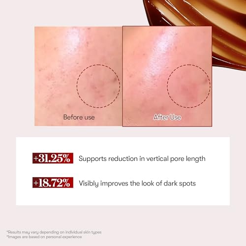 VT COSMETICS Red Booster Reedle Shot 100, Microneedling Serum with Dragon¡¯s Blood, Exosome, Soothing Relief Serum for Irritated, and Sun-Stressed Skin, Scalp Care, Korean Skincare 1.69 fl oz (50ml)