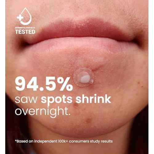 ROSELYNBOUTIQUE Pimple Patches for Face 300 Counts 4 Sizes Hydrocolloid Acne Patches with Tea Tree Oil,Zits Blemishes Pore Strips - Vegan Facial Skin Care Products Cruelty-Free