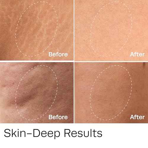 Hot Vita Vitamin C Body Oil ? Hydrating & Firming Natural Blend with Rosehip & Cypress Oils ? Evens Skin Tone, Reduces Cellulite Appearance, Boosts Radiance & Promotes Collagen Production