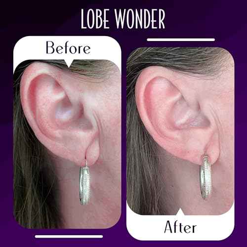 Lobe Wonder - The Original Ear Lobe Support Patch for Pierced Ears - Eliminates The Look of Torn or Stretched Piercings - Protects Healthy Ear Lobes from Tearing
