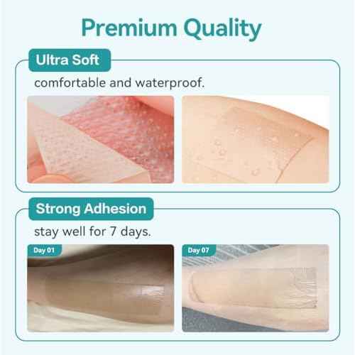 Dimora Medical Grade Silicone Scar Sheets -Ultra Soft Silicone Scar Tape (1.6¡±x60" Roll), Hypoallergenic Scar Removal Treatment for Surgical Scars, C Section, Tummy Tuck, Keloid Treatment