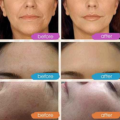 GLEOW Retinol Serum for Face, Vitamin C with Hyaluronic Acid Face Serum for Women and Men, Glow Skin Care Set Total Package Targets Appearance of Uneven Skin Tone and Dryness 3x1oz
