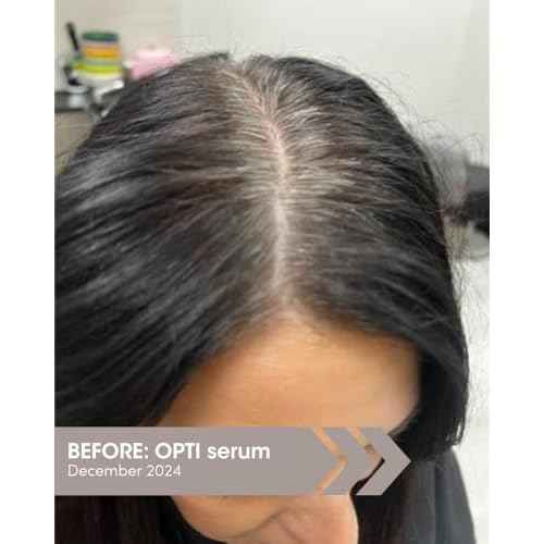 SEVEN SATARA OPTI Shampoo for Women & Men, Hair Growth & Thinning Solutions with Procapil + Capixyl, Promotes Fuller, Healthier Locks, Plant-Based Hair Shampoo for Vitality & Restoration, 32 fl oz