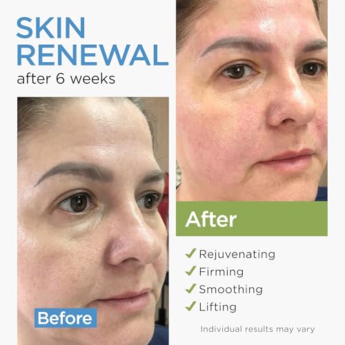 Collagen Face Cream with Stem Cells Retinol Hyaluronic Acid Niacinamide for All Skin Types - Anti-Aging Face Moisturizer with Airless Pump - Day & Night Cream for Wrinkles - Made in USA 1.7 Oz